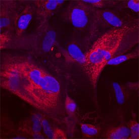 Phospho-Akt1 (T308) antibody in CCD-1070Sk Human Cell Line by Immunocytochemistry (ICC).