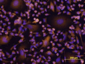 Akt antibody in MDA-MB-231 Human Cell Line by Immunocytochemistry (ICC).