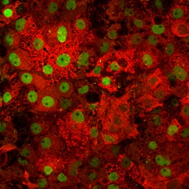 Albumin in Hepatocytes Derived from Human Embryonic Stem Cells. Albumin antibody in Hepatocytes Derived from Human Embryonic Stem Cells by Immunocytochemistry (ICC).
