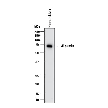 Detection of Human Albumin antibody by Western Blot.