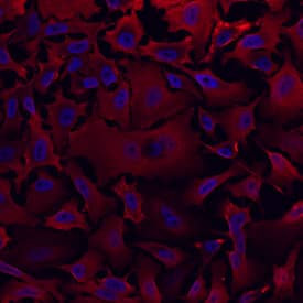Aldehyde Dehydrogenase 1-A1/ALDH1A1 antibody in HeLa Human Cell Line by Immunocytochemistry (ICC).