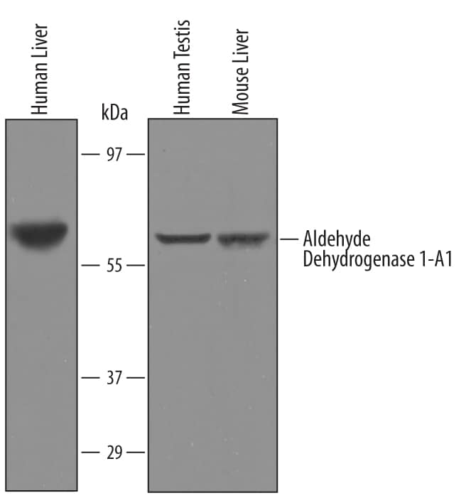 Detection of Human and Mouse Aldehyde Dehydrogenase 1-A1/ALDH1A1 antibody by Western Blot.