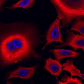 Aldehyde Dehydrogenase 1-A1/ALDH1A1 antibody in A549 Human Cell Line by Immunocytochemistry (ICC).