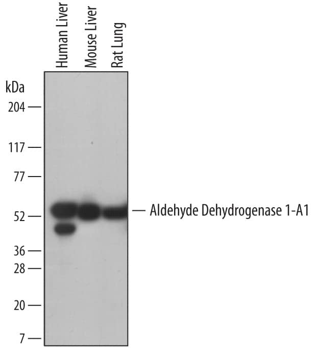 Detection of Human, Mouse, and Rat Aldehyde Dehydrogenase 1-A1/ALDH1A1 antibody by Western Blot.