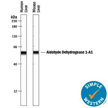 Detection of Human and Mouse Aldehyde Dehydrogenase 1-A1/ALDH1A1 antibody by Simple WesternTM.