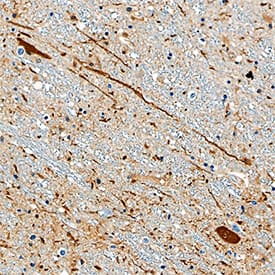 Aldehyde Dehydrogenase 1-A1/ALDH1A1 antibody in Human Brain by Immunohistochemistry (IHC-P).