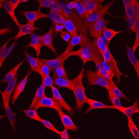 Aldo-keto Reductase 1C3/AKR1C3 antibody in LNCaP Human Cell Line by Immunocytochemistry (ICC).