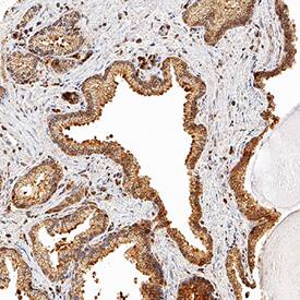Aldo-keto Reductase 1C3/AKR1C3 antibody in Human Prostate by Immunohistochemistry (IHC-P).