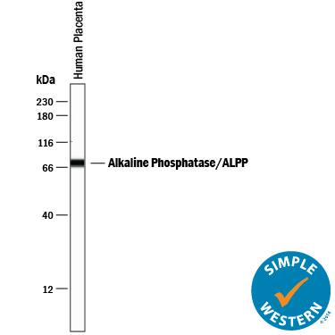 Detection of Human Alkaline Phosphatase/ALPP/ALPI antibody by Simple WesternTM.