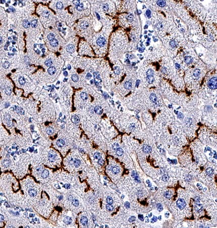 Aminopeptidase N/CD13 antibody in Human Liver by Immunohistochemistry (IHC-P).