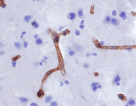 Aminopeptidase N/CD13 antibody in Human Brain by Immunohistochemistry (IHC-P).