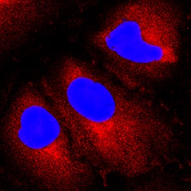Aminopeptidase PILS/ARTS1 antibody in A549 Human Cell Line by Immunocytochemistry (ICC).