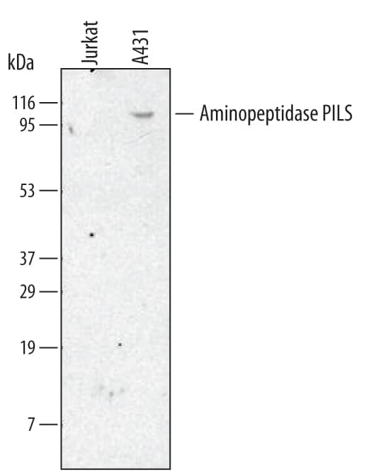 Detection of Human Aminopeptidase PILS/ARTS1 antibody by Western Blot.