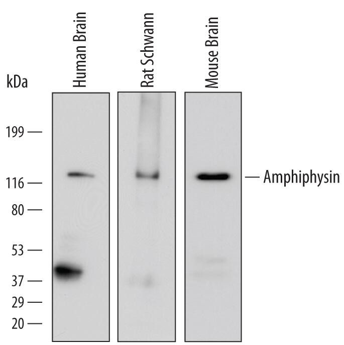 Detection of Human, Mouse, and Rat Amphiphysin/AMPH antibody by Western Blot.