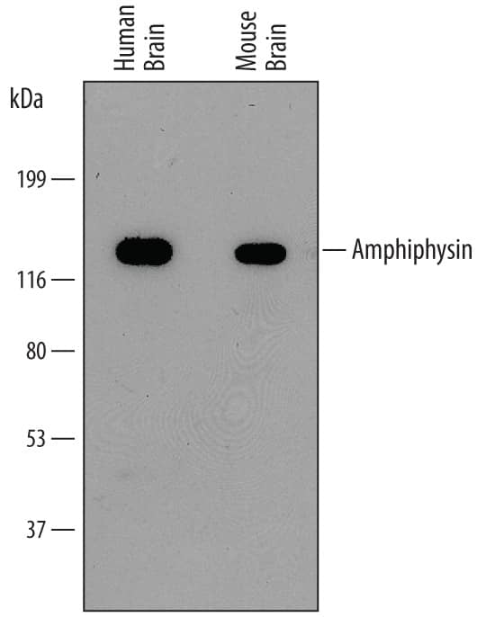 Detection of Human and Mouse Amphiphysin/ AMPH antibody by Western Blot.