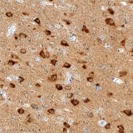 Amphiphysin/AMPH antibody in Human Brain by Immunohistochemistry (IHC-P).