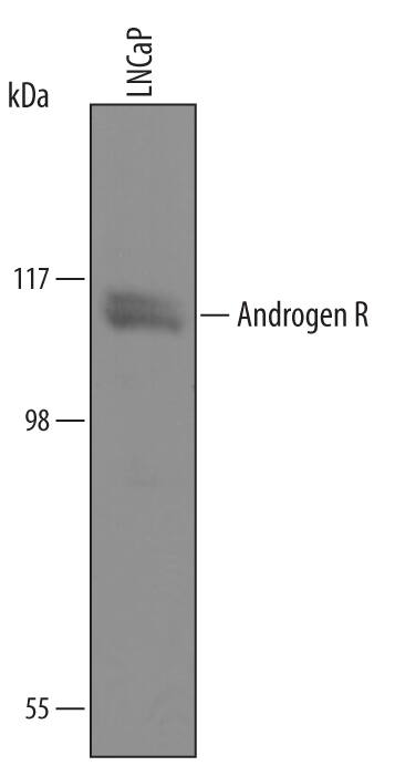 Detection of Human Androgen R/NR3C4 antibody by Western Blot.