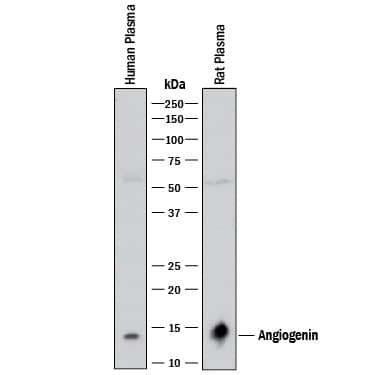 Detection of Human and Rat Angiogenin antibody by Western Blot.