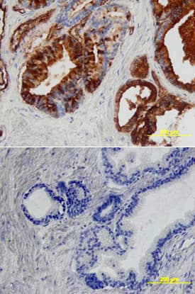 Angiopoietin-1 antibody in Human Prostate by Immunohistochemistry (IHC-P).
