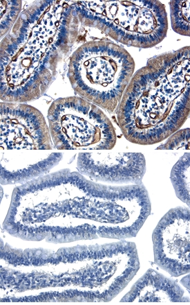 Angiopoietin-2 antibody in Human Gastrointestinal Cancer Tissue by Immunohistochemistry (IHC-P).