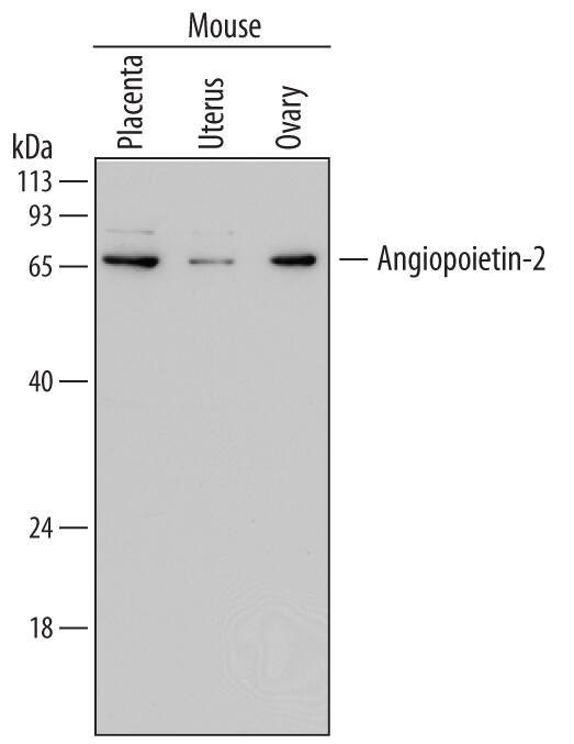 Detection of Mouse Angiopoietin-2 antibody by Western Blot.