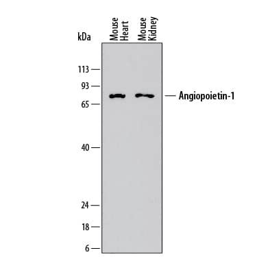 Detection of Mouse Angiopoietin-1 antibody by Western Blot.