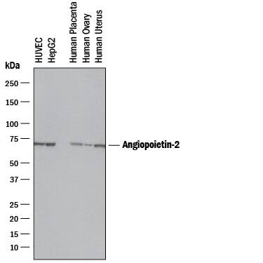 Detection of Human Angiopoietin-2 antibody by Western Blot.