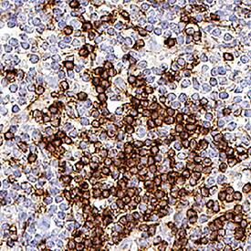 Angiopoietin-2 antibody in Mouse Lymph Node Tissue by Immunohistochemistry (IHC-Fr).
