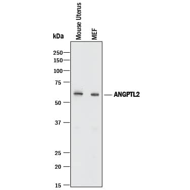 Detection of Mouse Angiopoietin-like Protein 2/ANGPTL2 antibody by Western Blot.