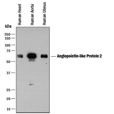 Detection of Human Angiopoietin-like Protein 2/ANGPTL2 antibody by Western Blot.