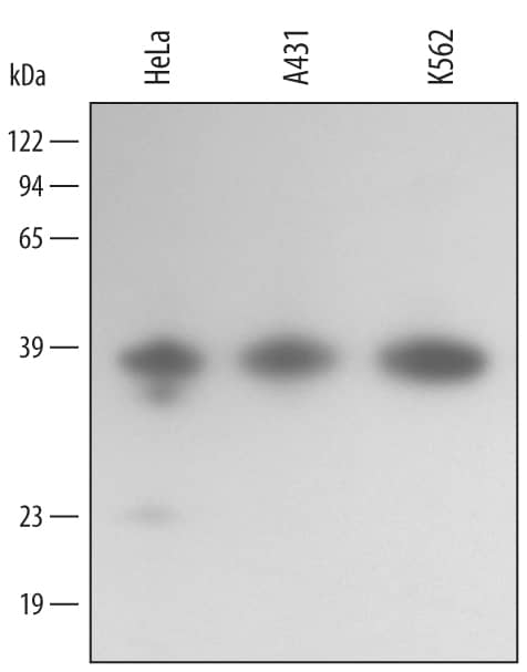 Detection of Human Annexin A10 antibody by Western Blot.