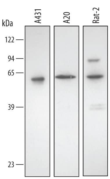 Detection of Human/Mouse/Rat Annexin A11 antibody by Western Blot.