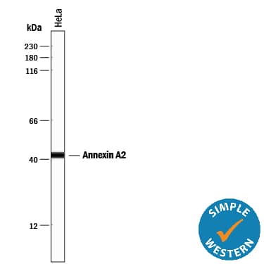 Detection of Human Annexin A2 antibody by Simple WesternTM.