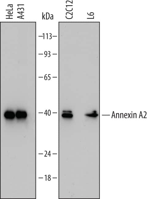 Detection of Human, Mouse, and Rat Annexin A2 antibody by Western Blot.