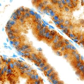 Annexin A3 antibody in Human Prostate by Immunohistochemistry (IHC-P).