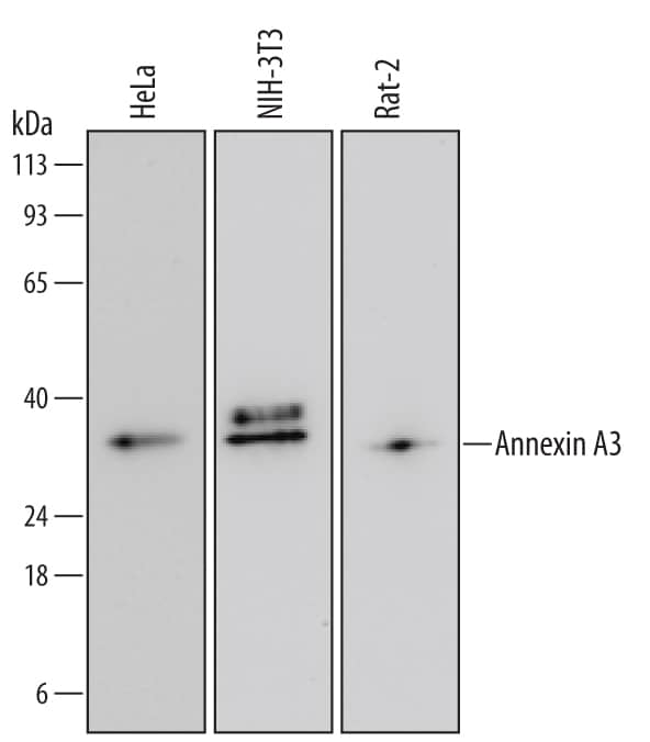 Detection of Human, Mouse, and Rat Annexin A3 antibody by Western Blot.