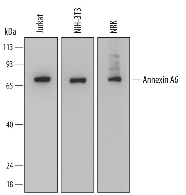 Detection of Human, Mouse, and Rat Annexin A6 antibody by Western Blot.