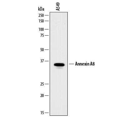 Detection of Human Annexin A8 antibody by Western Blot.