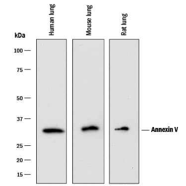 Detection of Human, Mouse, and Rat Annexin V antibody by Western Blot.