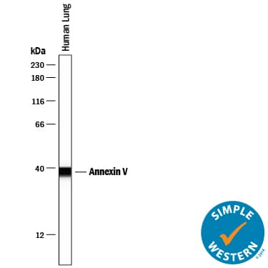Detection of Human Annexin V antibody by Simple WesternTM.