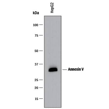 Detection of Human Annexin V antibody by Western Blot.