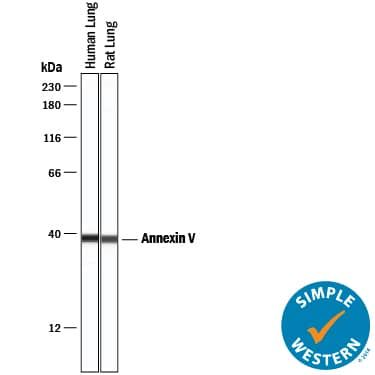 Detection of Human Annexin V antibody by Simple WesternTM.
