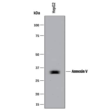 Detection of Human Annexin V antibody by Western Blot.