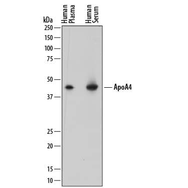 Detection of Human Apolipoprotein A-IV/ApoA4 antibody by Western Blot.