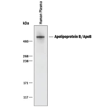 Detection of Human Apolipoprotein B100/ApoB100 antibody by Western Blot.