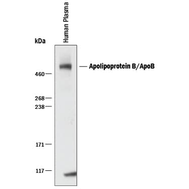 Detection of Human Apolipoprotein B/ApoB antibody by Western Blot.