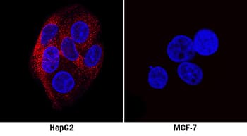 Apolipoprotein B/ApoB antibody in Human HepG2 and MCF-7 Cell Lines by Immunocytochemistry (ICC).