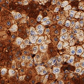 Apolipoprotein B/ApoB antibody in Human Liver by Immunohistochemistry (IHC-P).