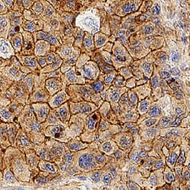 Apolipoprotein B/ApoB antibody in Human Liver by Immunohistochemistry (IHC-P).