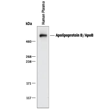 Detection of Human Apolipoprotein B/ApoB antibody by Western Blot.